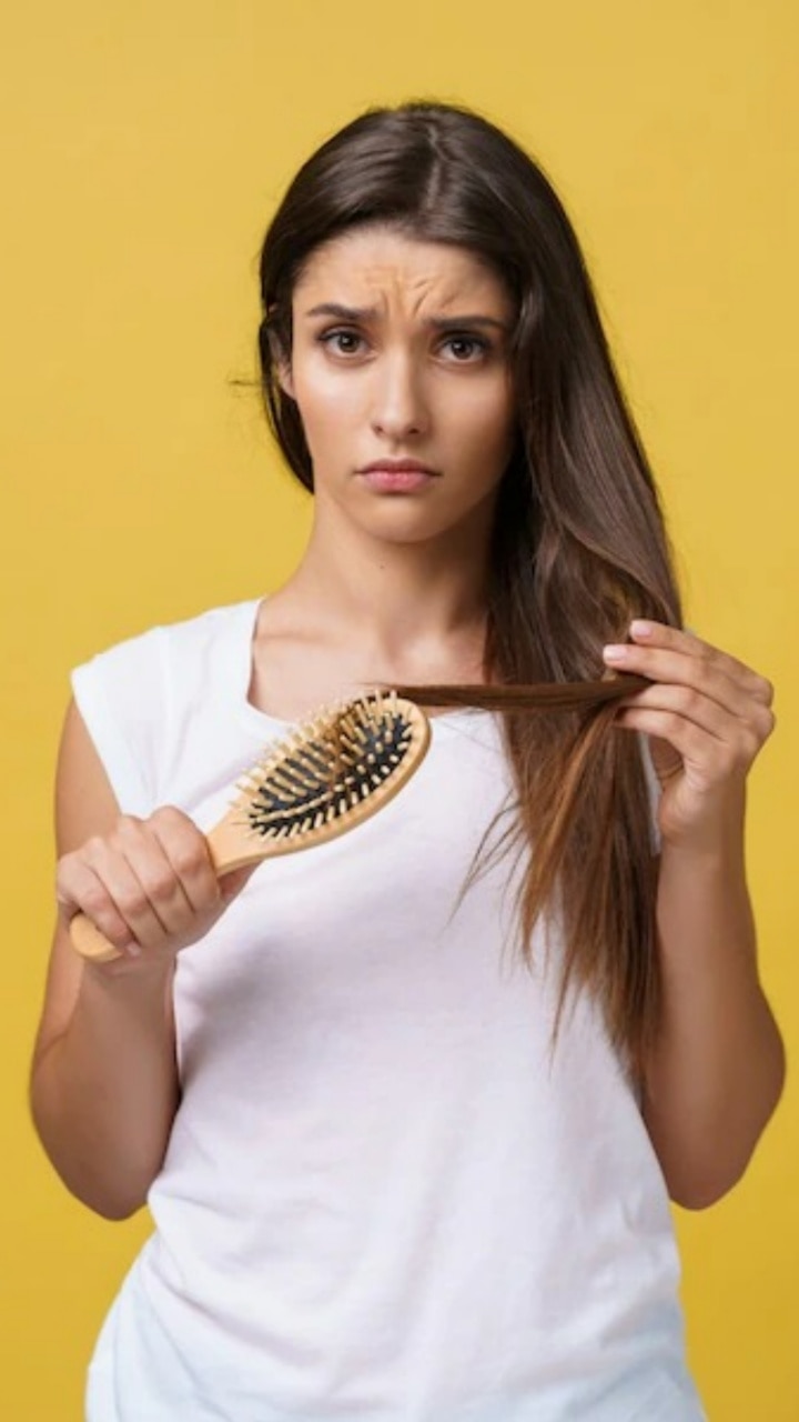 9-tips-to-control-hair-fall-naturally