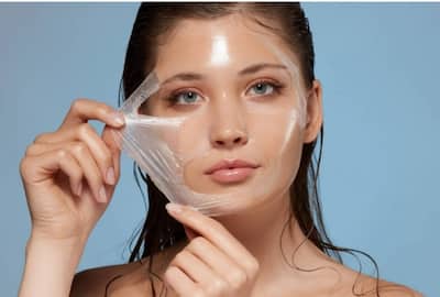 Chemical Peels: Do They Really Work And Are Effective For Treating Acne?  Here