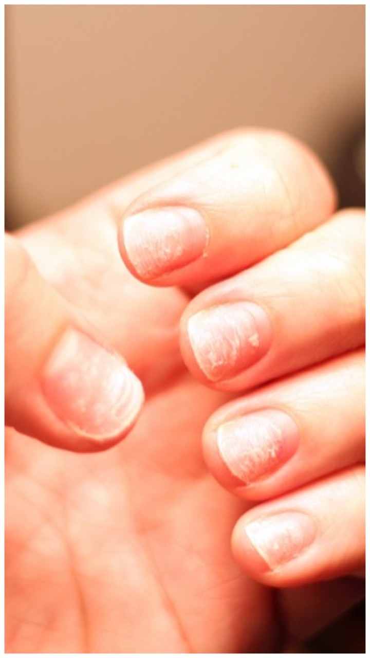 घरच्या घरी अशा प्रकारे घ्या खराब होणाऱ्या नखांची काळजी | how to take care  of brittle nails at home In Marathi