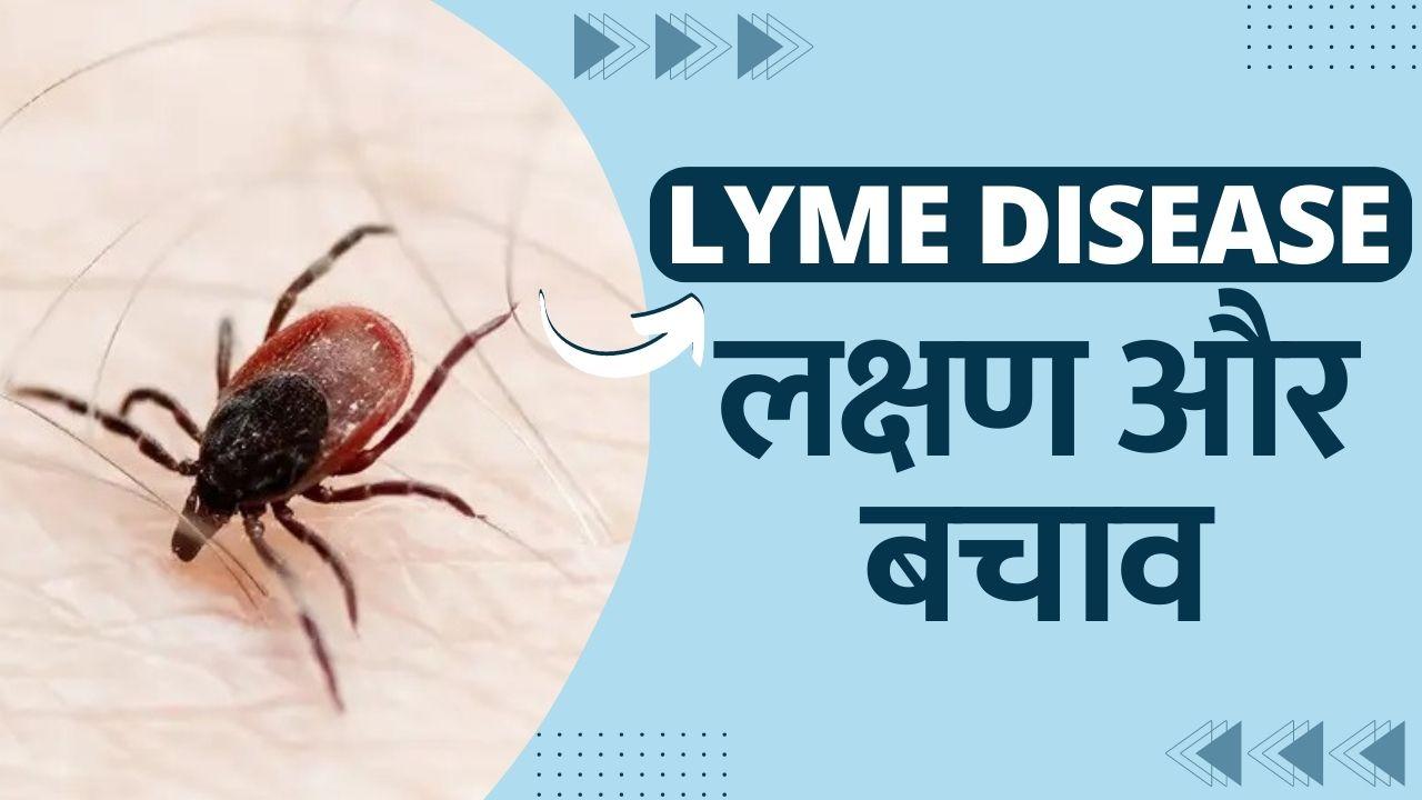 Lyme Disease क्या है Lyme Disease? जिससे सुपरमॉडल Bella Hadid पिछले 15