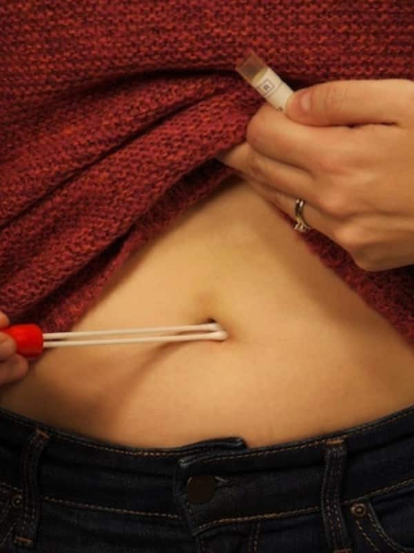 cigarette in belly button What Does The Shape Of Your Navel Say About Your Health