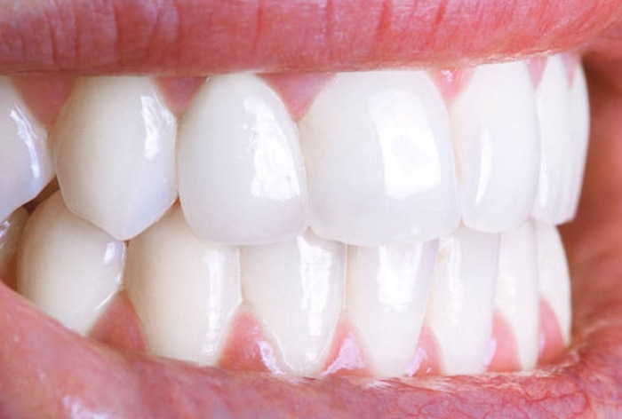7 Foods for Healthy Teeth and Gums