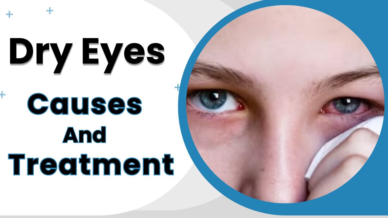Dry Eyes: Causes, Symptoms, and Treatment | India.com