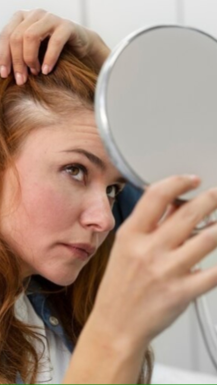 8-natural-ways-to-reduce-hair-thinning