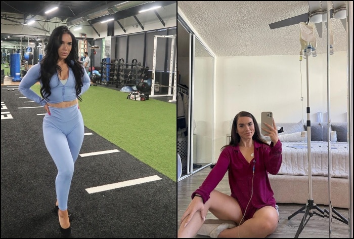 What is Mycobacterium Abscessus, Health Condition Fitness Influencer Beatriz Suffers From Post Fat Burning Injection?