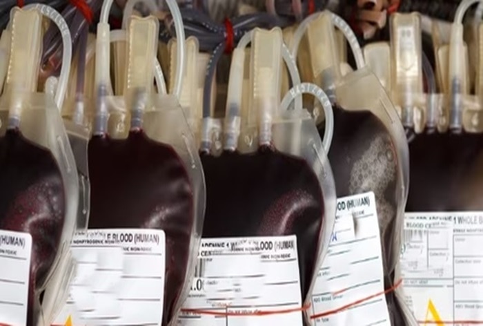 14 Children Undergoing Blood Transfusions Infected With HIV, Hepatitis in Kanpur Hospital