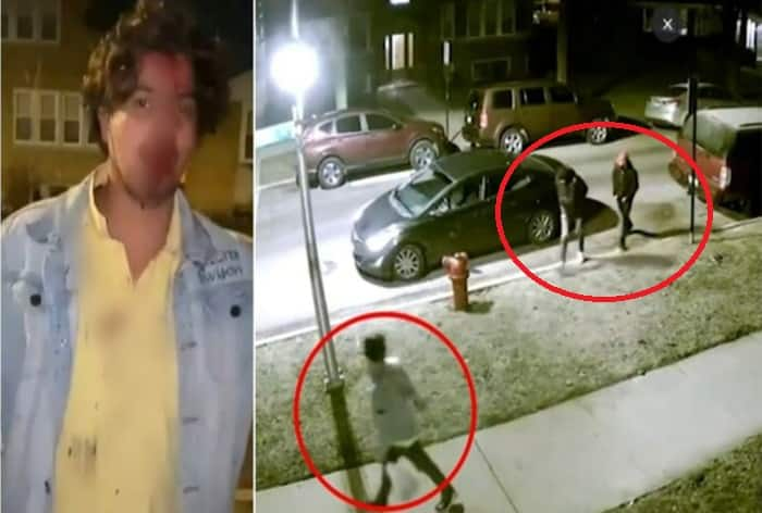 Video: Indian Student From Hyderabad Brutally Attacked And Robbed In Chicago, Found Profusely Bleeding