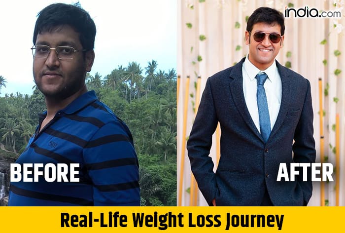 Real-Life Weight Loss Story: How Dr Shashank Singhal Lost 30 Kgs in Less Than a Year With Cold Coffee, Pizza And Burger - Exclusive