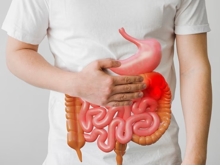 Colon Cancer Symptoms: Why Youngsters Are Prone to This Deadly Condition? 5 Ways to Prevent Its Risk