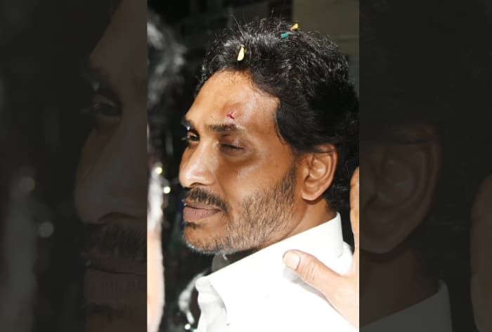 Breaking News: Andhra Pradesh CM Jagan Mohan Reddy Injured After Stone Hurled At Him In Vijayawada