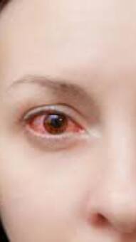 ये हैं Eye Cancer के शुरुआती लक्षण, हो जाएं सावधान