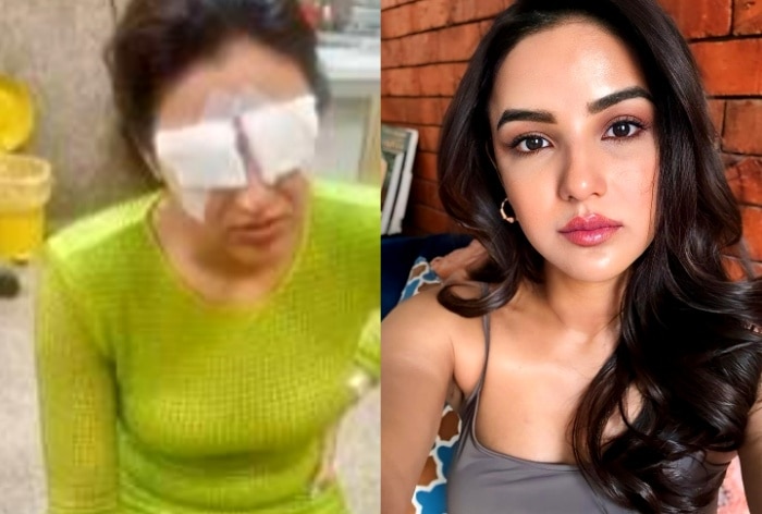 Jasmin Bhasin Says She ‘Can’t See Properly’ After Suffering Corneal Damage Due to Lenses