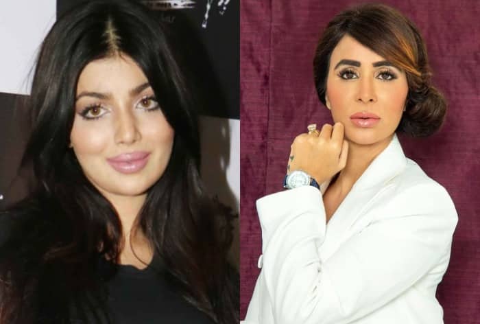 What Went Wrong With Ayesha Takia's Surgery? Dr Shagun Gupta, Permanent Makeup Expert Explains | Exclusive