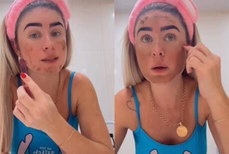Bootyful Remedy! Brazilian Influencer Uses Poop Face Mask To Prevent Aging, Internet Shocked – WATCH