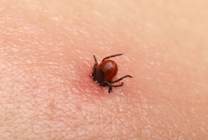 Wetland virus in China: Know causes, symptoms and treatment of this new-tick borne infection