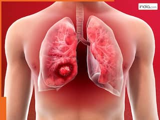 Lung Cancer के जोखिम को कम करने के लिए करना होगा ये काम, बढ़ जाएगी उम्र