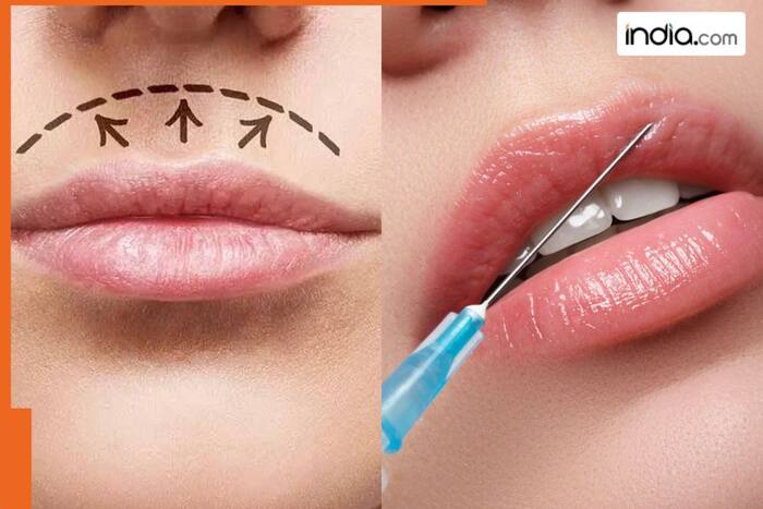 Lip filler vs lip lift: Which is the right option for you?