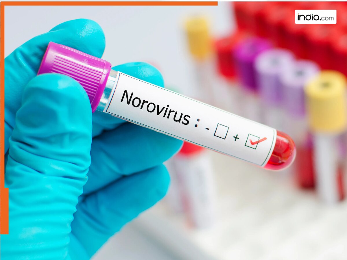 क्या बला है Norovirus? इस देश में तेजी से बढ़ रहे हैं इंफेक्शन के मामले, जानें लक्षण