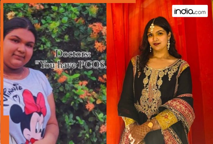 This woman lost 38 kgs reversing PCOS, managing diabetes; Shares 10 weight loss mistakes to avoid