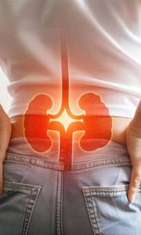 किडनी फेल होने के क्या होते हैं शुरुआती लक्षण!