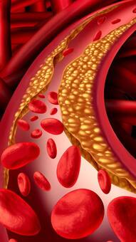 रोज सुबह खाली पेट खाएं ये सफेद चीज, कम होने लगेगा कोलेस्ट्रॉल