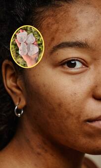 चेहरे के जिद्दी दागों को गायब कर देगा ये सफेद पत्थर! जानें कैसे करें इस्तेमाल?