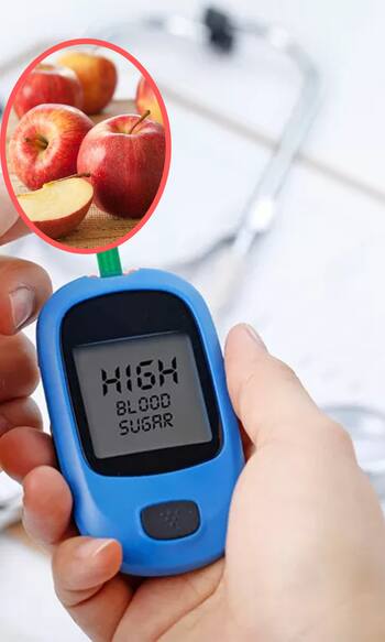 डायबिटीज में सेब खाना चाहिए या नहीं?