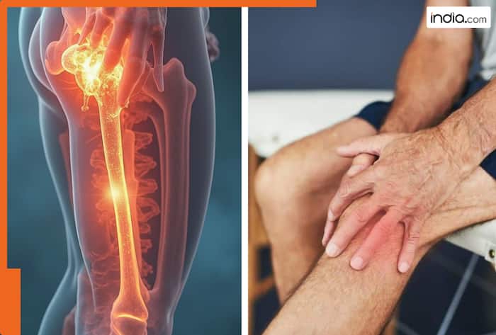 what are the initial symptoms of arthritis gathiya ke lakshan in hindi