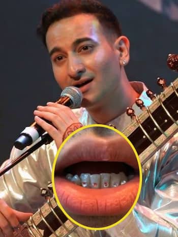 'मेरे दांतों में हीरे जड़े हैं'
