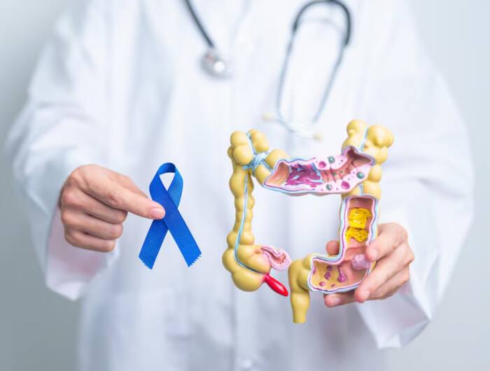 What is Colon cancer