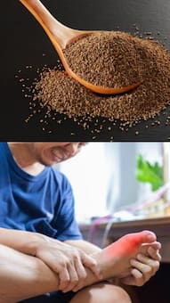 जोड़ो में जमे Uric Acid को चुटकियों में बाहर निकाल फेंकेगा किचन में रखा ये मसाला