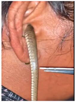 महिला के कान में घुस गया सांप, निकलवाने गई तो हो गया ऐसा हाल