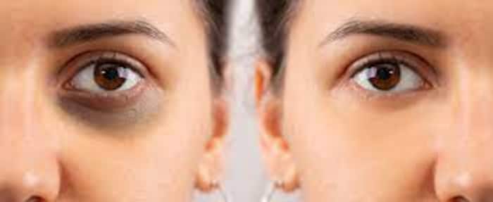 Shehnaz Hussain Skin Care Tips