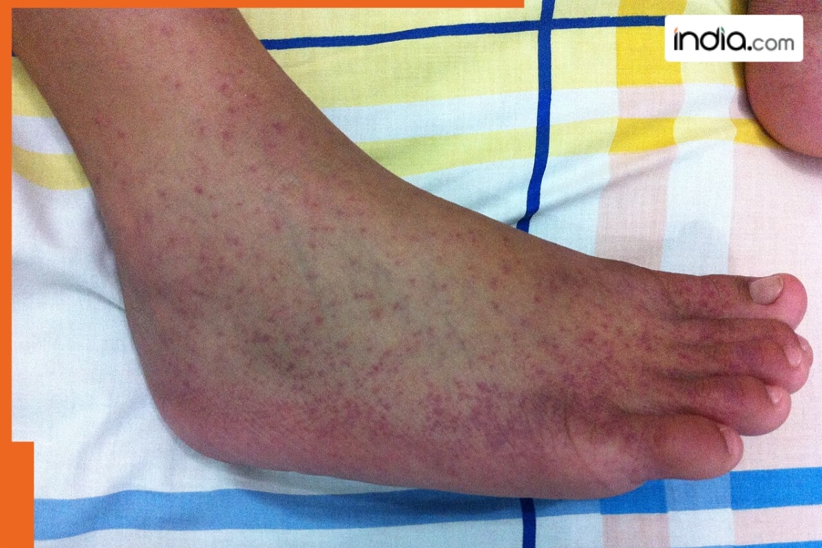 China under grip of this disease, hospitals are crowded, it is…