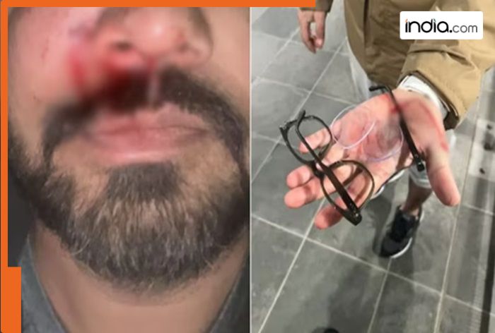 ‘They left me bleeding…’: Indian-origin man suffers fractured cheekbone after brutal attack in alleged hate crime in Ireland