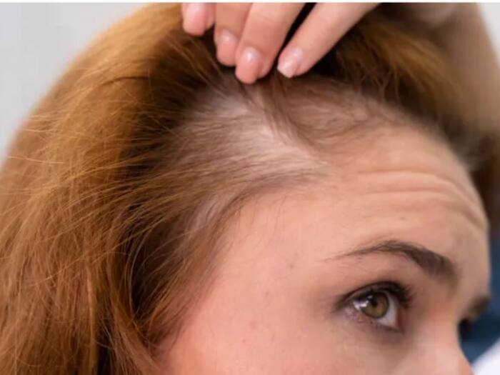 What causes a sore scalp
