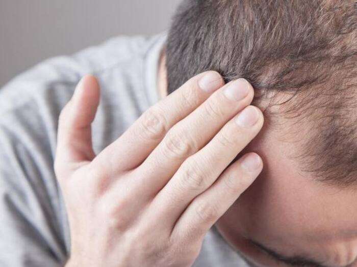 Which deficiency of vitamins causes hair fall