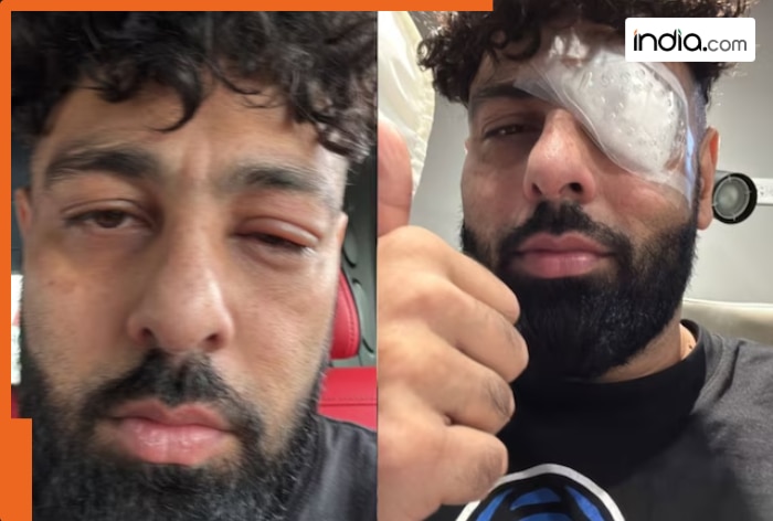Rapper Badshah shares photos with swollen eye and bandage, fans ask ...