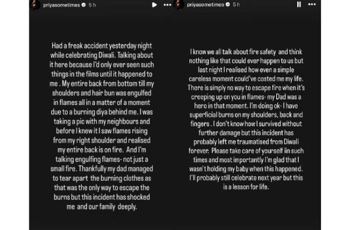 This Bigg Boss fame actress narrowly escaped death on Diwali, a tragic accident occurred, her body almost…, her name is…