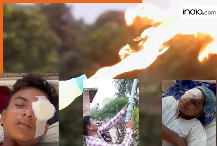 Carbide Guns, children, eyesight, Instagram trend, Madhya Pradesh, Bihar, Diwali, firecracker guns, Uttar Pradesh, Bhopal, Indore, Gwalior, Jabalpur, Vidisha district, calcium carbide gun, Patna, YouTube challenge videos