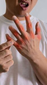 7 fruits that help in lowering uric acid naturally