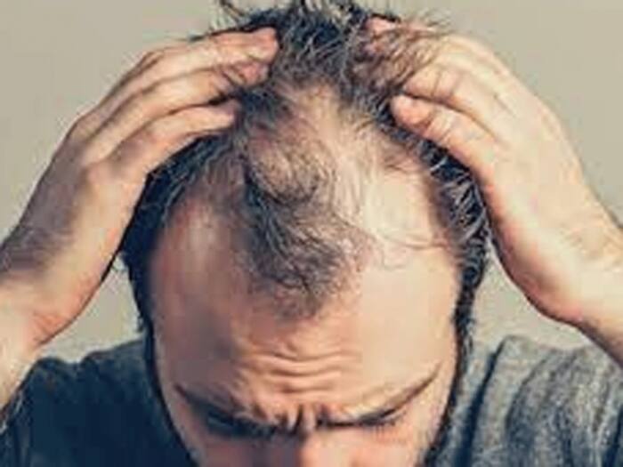 Hairfall astro reason