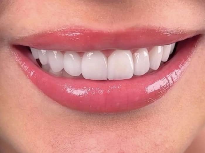 Calcium Deficiency Symptoms