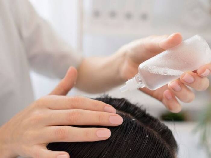 Easy home remedies to reduce dandruff