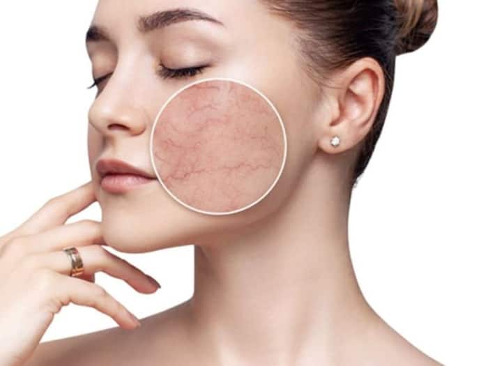 Dry Skin Home Remedies