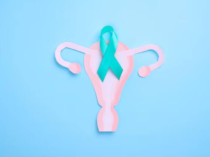 Cervical Cancer  2