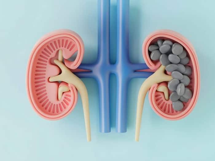 Patharchatta Benefits  4