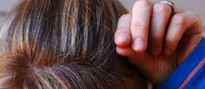 White hair remedies