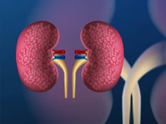 Kidney  1