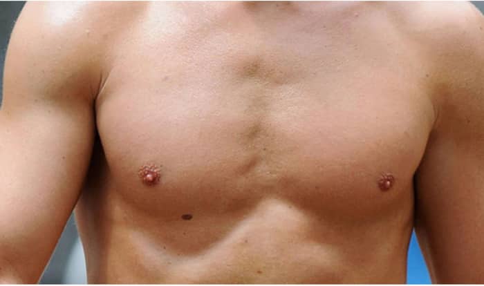 1437805700mole on right chest